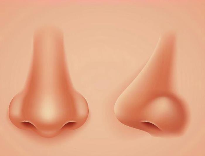 隆鼻一般要多少钱，女子花4.2万隆鼻