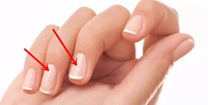 指甲上有白斑是怎么回事（指甲上出现小白斑意味着什么）