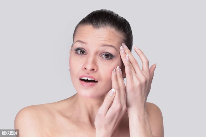 怎么消除眼角纹（改善眼角纹其实并不用药）