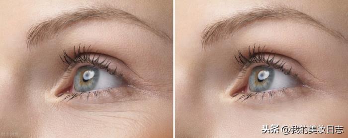 怎样去除细纹（这四招教你如何快速去除细纹）