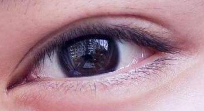 眼睛浮肿怎么消除（眼睛浮肿怎么快速消除）