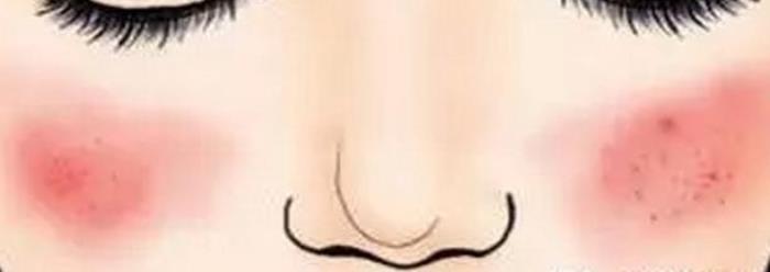 修复脸部皮肤（1分钱修复皮肤之法）