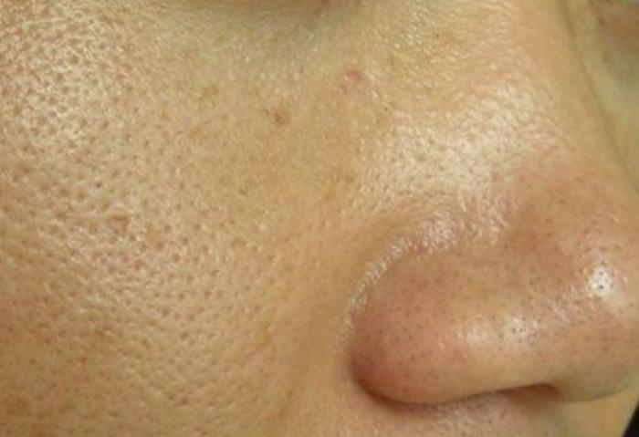 皮肤粗糙怎么保养（皮肤粗糙显老怎么办）