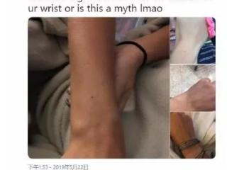 手腕上的痣图解大全（每个人手腕或手臂中央都有一颗痣）