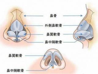 鼻头缩小整形（鼻头缩小手术怎么做）