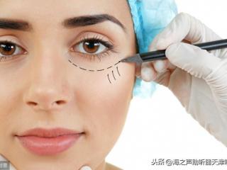除皱激光多少钱（影响激光除皱价格的因素）