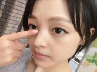 鼻尖长痘是什么原因（鼻子上长痘痘的原因）