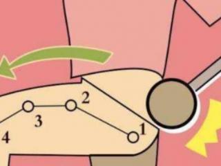 纠结图片（经常忧虑、恐惧、纠结）