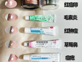 痘印怎么快速去掉（如何快速祛痘印合集）