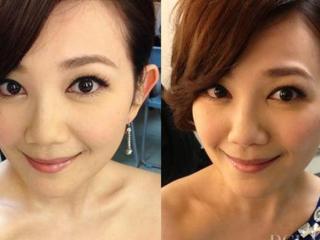 美白针多少钱一个疗程（身边的朋友都打美白针）