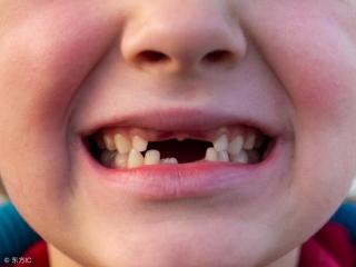 女人梦见掉牙，以往说梦见掉牙和老人相关