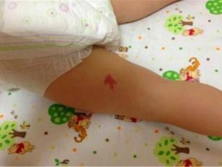 胎记的传说与前世（听说胎记暗示前世死法）