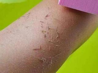 身上有脏东西的表现（人身上哪些地方比较脏）