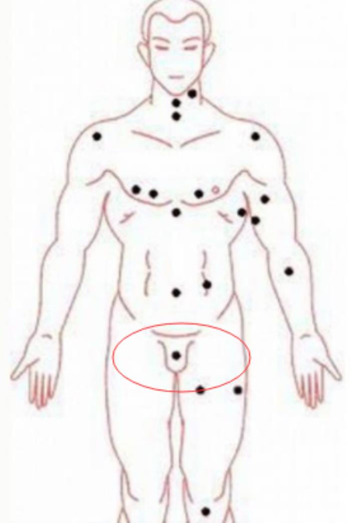 屁股有痣的女人细数女人身上的幸福好运痣