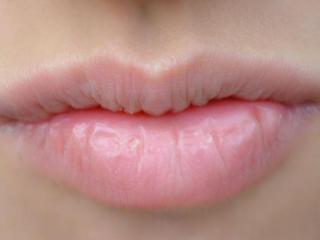 嘴唇干裂脱皮是什么原因（嘴巴总是干裂起皮是怎么回事）