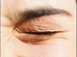 去细纹的眼霜（三款堪称皱纹小熨斗贵妇眼霜）