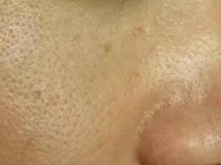 怎样让毛孔变小皮肤细腻（毛孔粗大只因这4件事做多了）