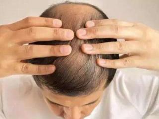 经常戴帽子会脱发吗（经常戴帽子会不会影响头发的生长）