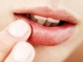 嘴唇发麻是什么原因（嘴唇发麻可能有这些疾病）