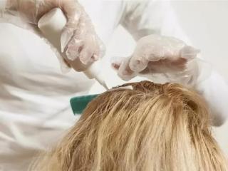 硫磺皂洗头去头皮屑吗（江苏女子坚持用硫磺皂水洗头）