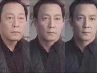 怎么去掉大眼袋（整形医生教您如何去除大眼袋）