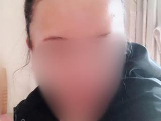 如何降低发际线（如何让高出天际的发际线降低一点）