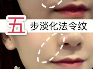 法令纹怎么消除简单方法（简单5步淡化法令纹）