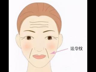 法令纹怎么形成的（法令纹是如何形成的）