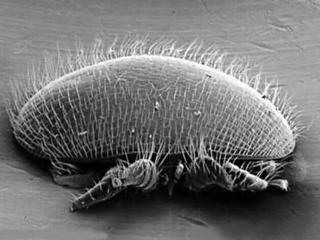 脸上螨虫怎么除（把螨虫一点一点扼杀）