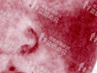 敏感肌肤怎样修复（抗敏修复全攻略来了）