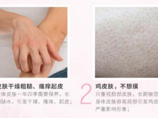 身体皮肤干怎么办（全身皮肤干燥怎么办）