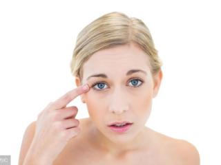 眼睛有鱼尾纹怎么办（鱼尾纹使颜值大打折扣）