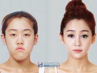 韩国整容节目（来看看韩国整形外科真人秀）