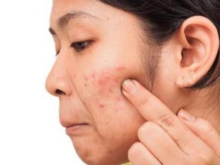 脸油怎么改善（三招教你告别满脸油光）