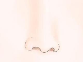 鼻子上毛孔洞怎么修复（黑头挤完鼻子上有洞眼怎么办）