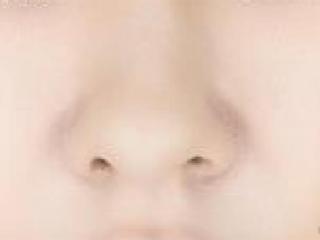 鼻子毛孔粗大挤有白色（挤出的白色物体是什么）