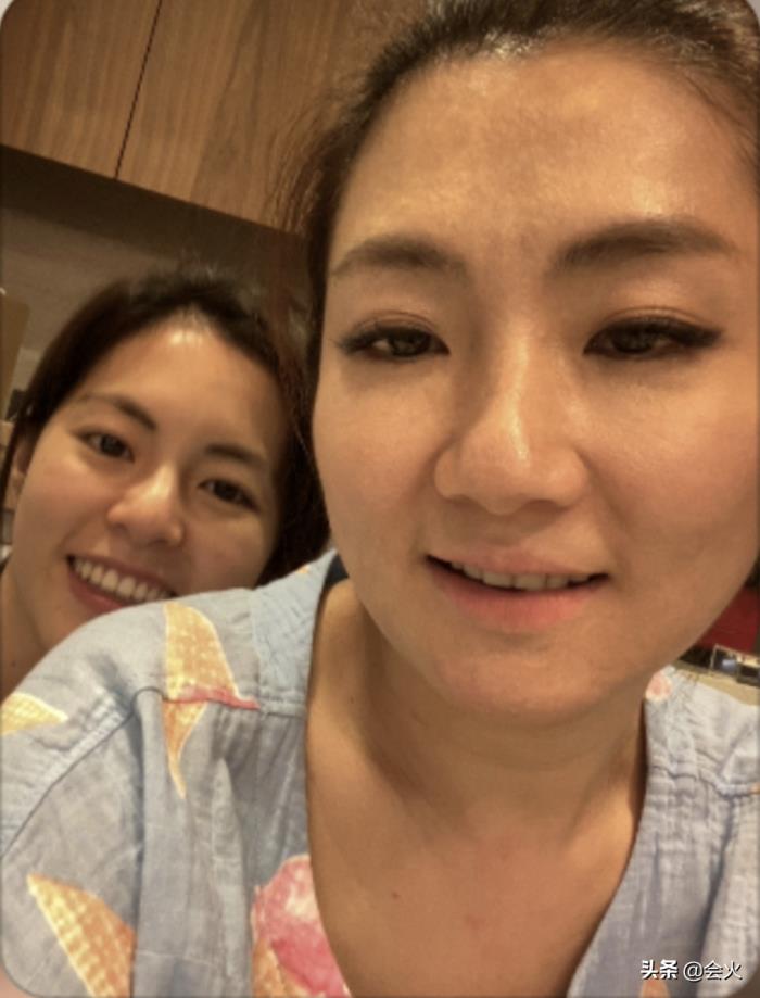 任家萱烧伤图片she任家萱素颜无修近照曝光