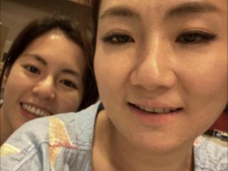 任家萱烧伤图片（SHE任家萱素颜无修近照曝光）