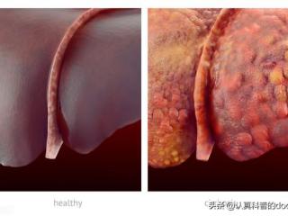 白天不痒晚上痒，晚上比白天还痒