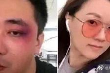 王自健家暴（王自健被妻子家暴细节曝光）