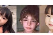 歌舞伎综合征能活多久（歌舞伎综合征）